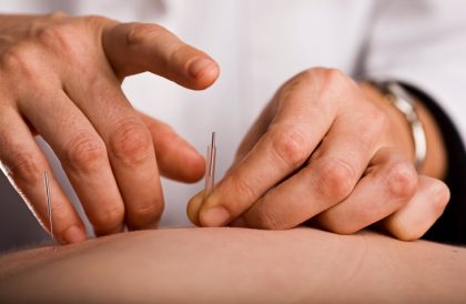 Acupuncturist prepares to tap needle into patients hand